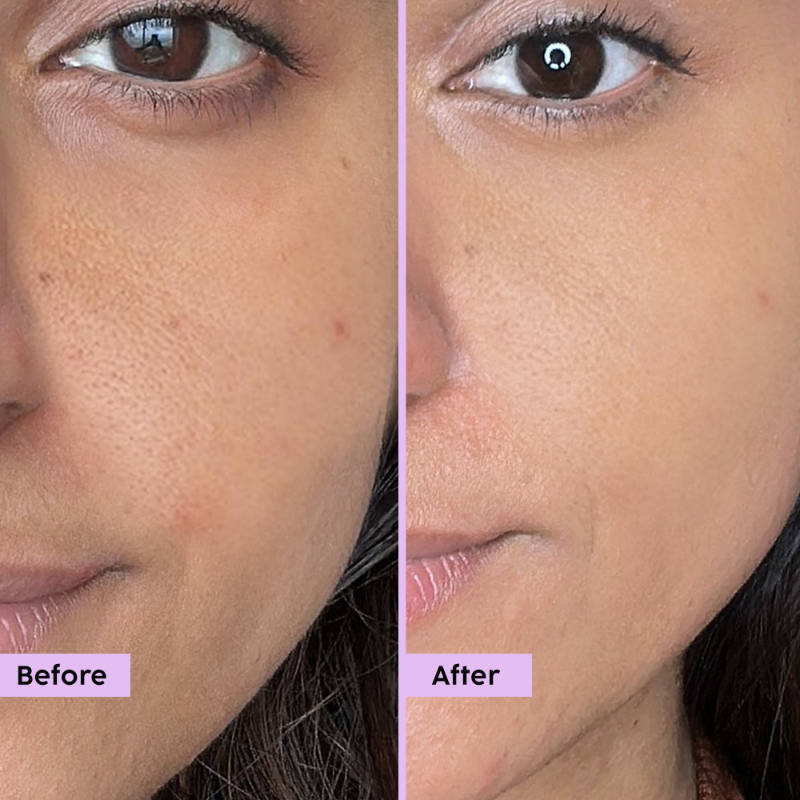 Jamun Active Acne Regime With Cleanser & Toner To Unclog Pores & Reduce Acne | PL1 - view 14