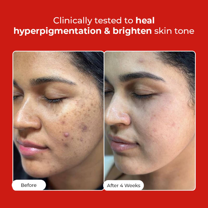 +5 Antioxidant Complex Rapid Glow & Brightening Face Serum | Z8 - view 2
