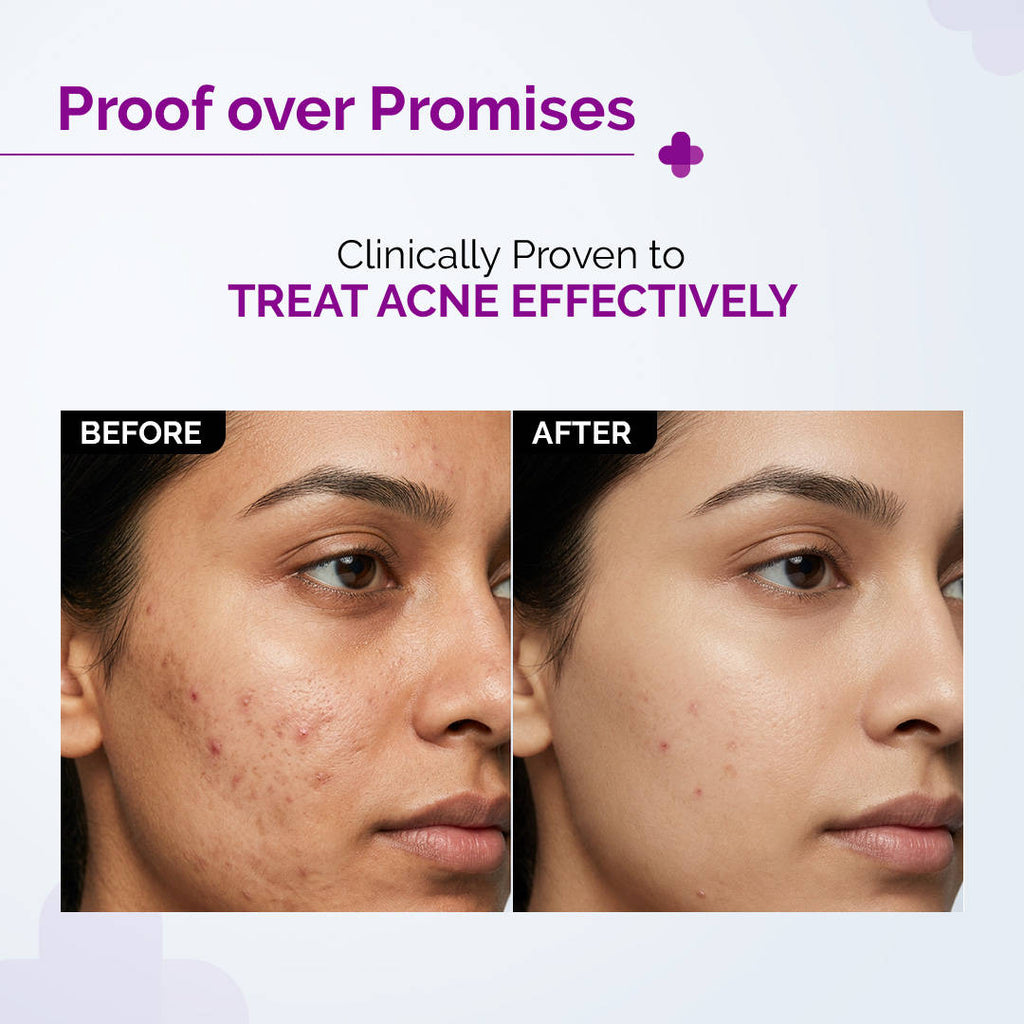 2% Salicylic Acid Face Serum | Z8 - view 8