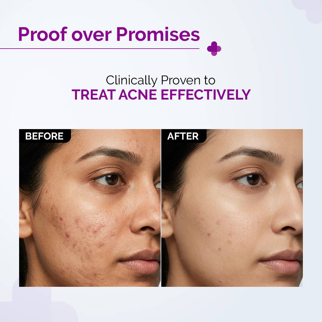 2% Salicylic Acid Face Serum | Z8 - view 8
