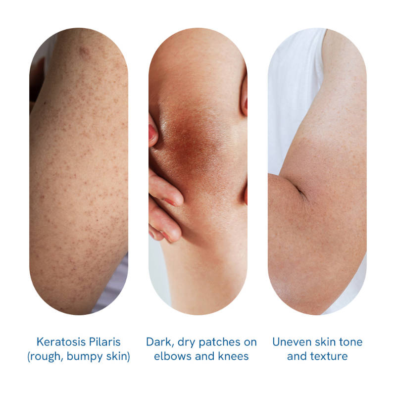 5% Lactic Acid Body Lotion - For 24H Moisturization, Improved Skin Texture, Smooth Skin | BWS9 - view 3