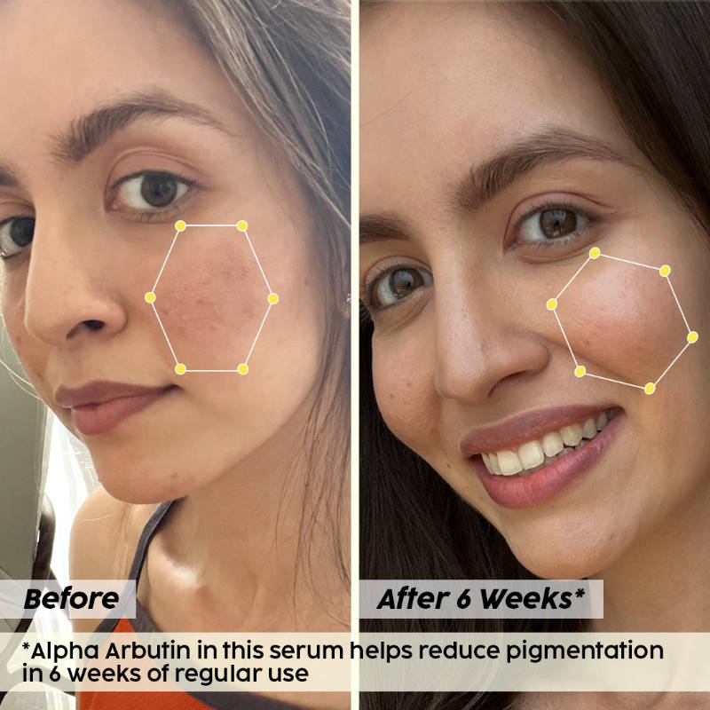 2% Alpha Arbutin Pineapple Serum for Pigmentation & Dark Spot Reduction | PL1 - view 18