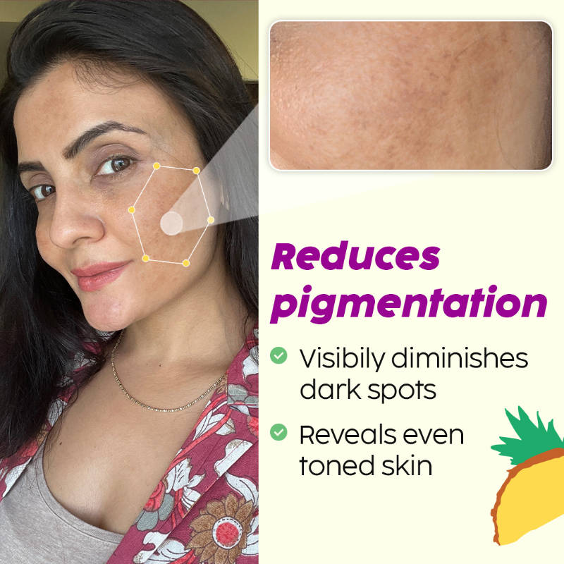 2% Alpha Arbutin Pineapple Serum for Pigmentation & Dark Spot Reduction | Z8 - view 16