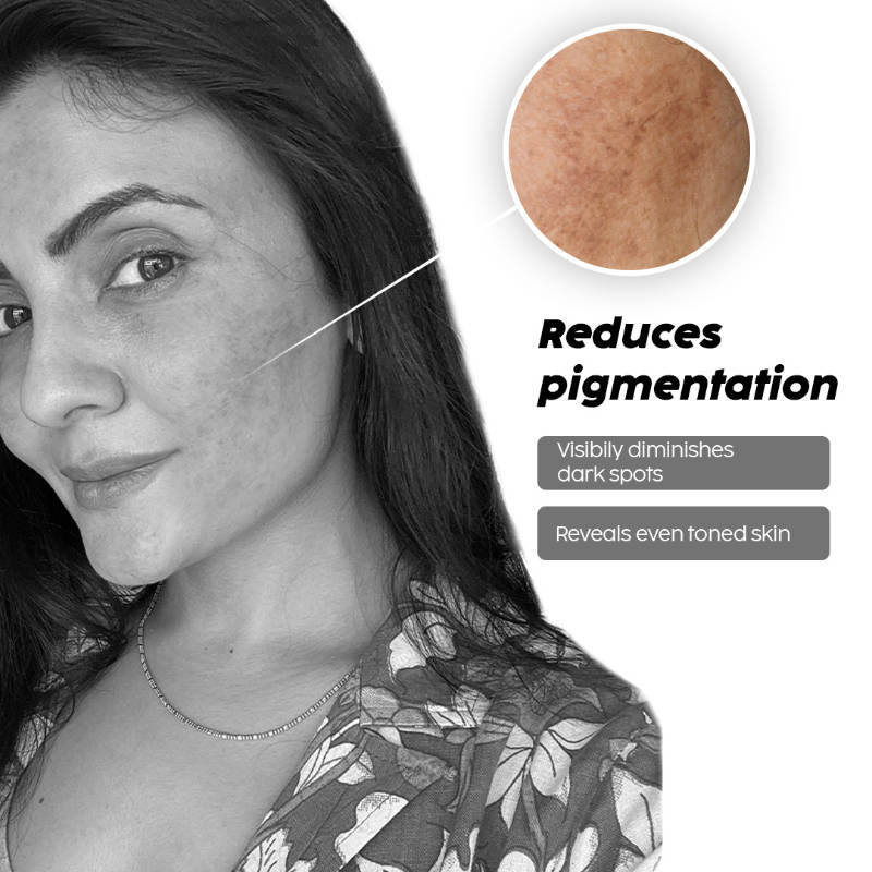 2% Alpha Arbutin Pineapple Serum for Pigmentation & Dark Spot Reduction | Z8 - view 17