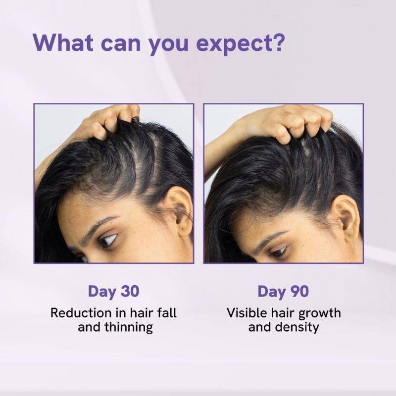 Advanced Hair Growth Serum - 3% Rosemary, 3% Redensyl, 2% Aminexil - For New Hair Growth | BWS9 - view 6