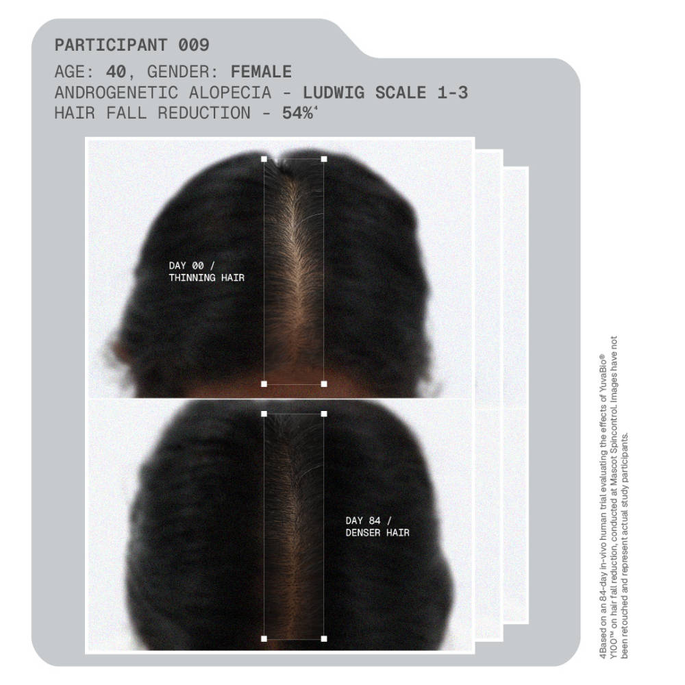 MitoActive Hair Growth Serum India's First Mitochondrial Hair Growth Serum Reduces Hair Fall | H85 - view 10