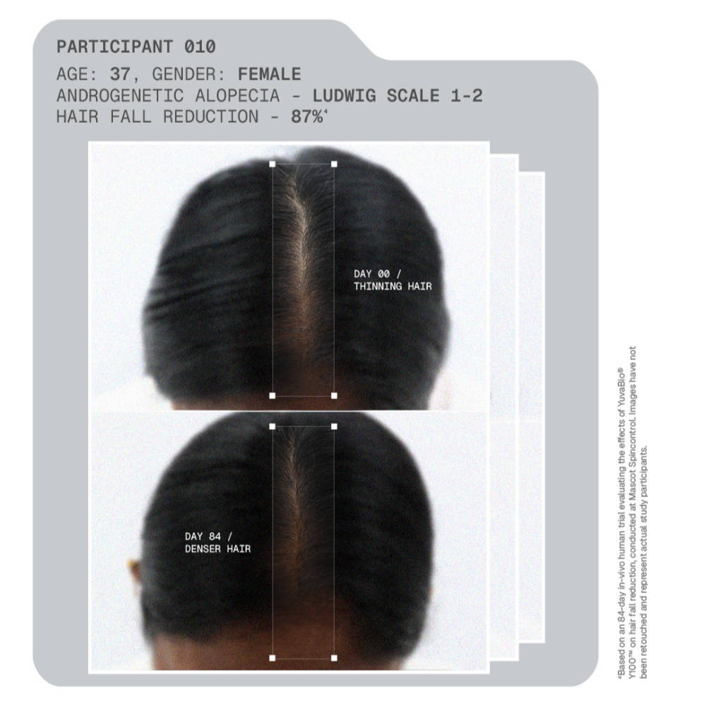 MitoActive Hair Growth Serum India's First Mitochondrial Hair Growth Serum Reduces Hair Fall | H85 - view 11