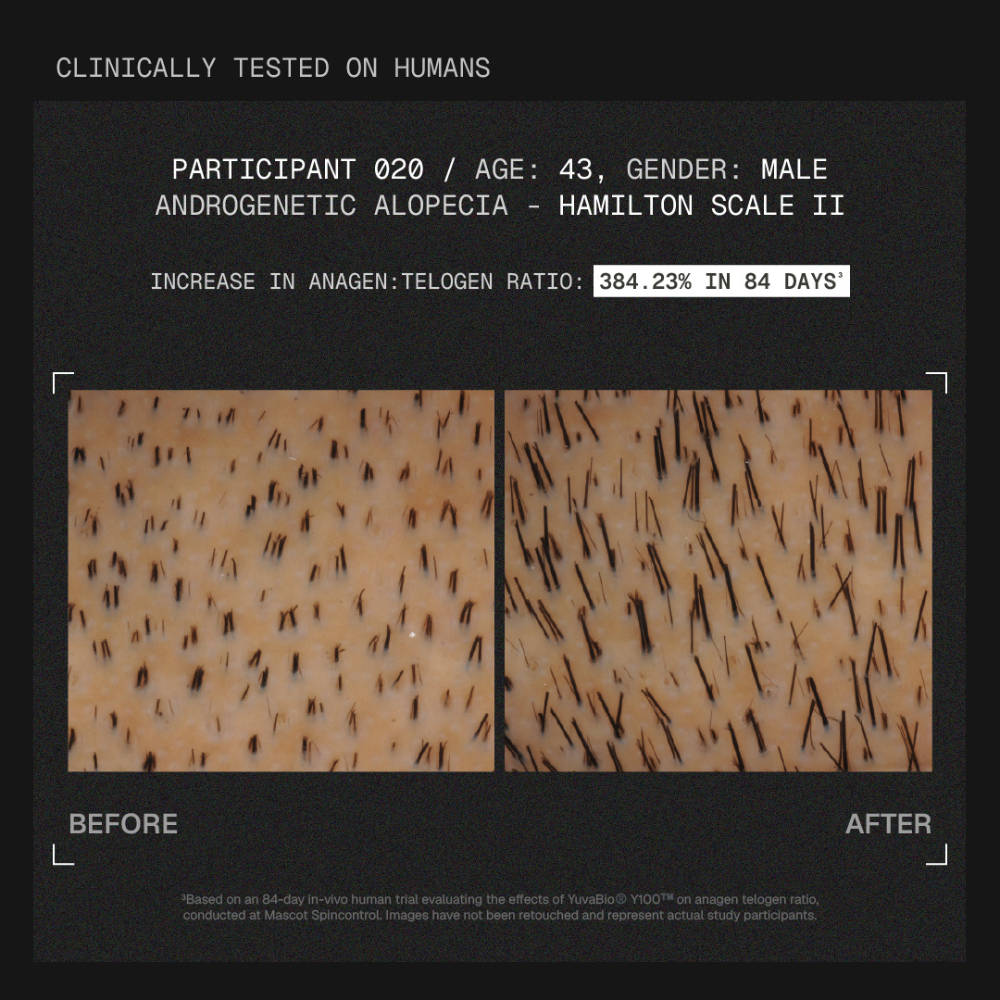 MitoActive Hair Growth Serum India's First Mitochondrial Hair Growth Serum Reduces Hair Fall | H85 - view 7