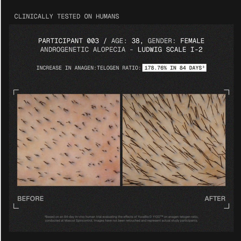 MitoActive Hair Growth Serum India's First Mitochondrial Hair Growth Serum Reduces Hair Fall | H85 - view 9
