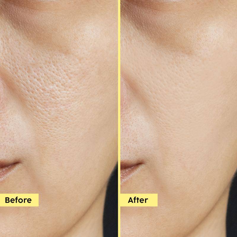Pineapple 3% Hyloglo PHA Alcohol Free Face Toner | PL1 - view 4