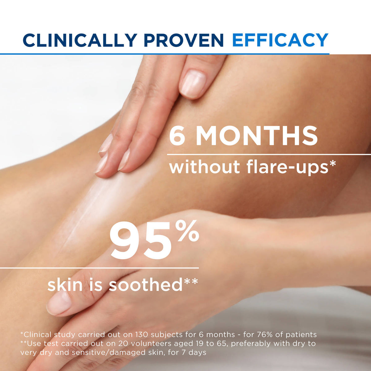 Anti-Itching Balm-Atoderm Intensive Baume-Ceramides & Canola Oil-Eczema Prone Skin | FC3 - view 5