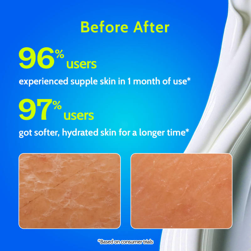 Hydrating Body Lotion with Rice Water & Hyaluronic Acid, Moisturizer for Dry Skin | B20 - view 2
