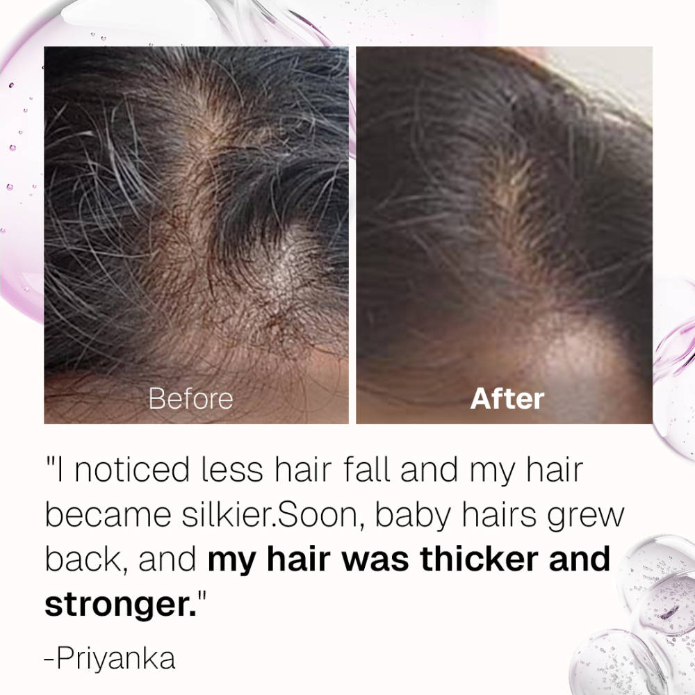 Pro+ Hair Serum With Tetrapeptides | H85 - view 6