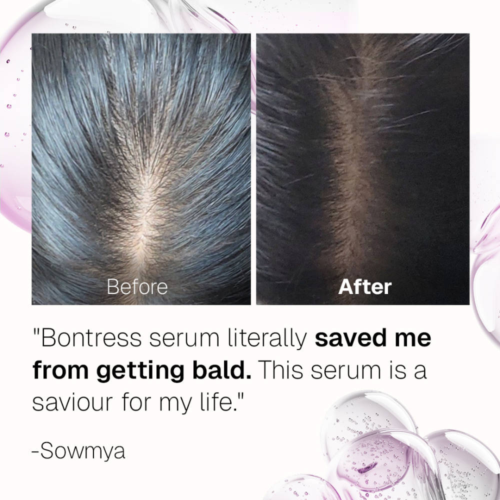 Pro+ Hair Serum With Tetrapeptides | H85 - view 7