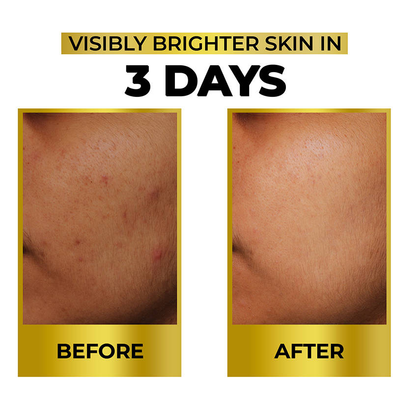 Bright & Shine Face Serum For Brightening, Dark Spots Reduction | Z8 - view 9