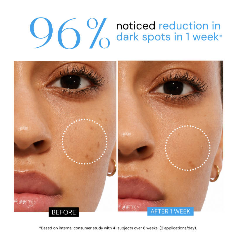 Barrier Repair Face Serum with 10% Niacinamide + 5 Ceramides + Alpha Arbutin for Dark Spots | Z8 - view 3