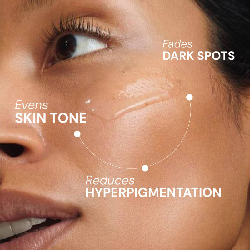 Barrier Repair Face Serum with 10% Niacinamide + 5 Ceramides + Alpha Arbutin for Dark Spots | Z8 - view 5