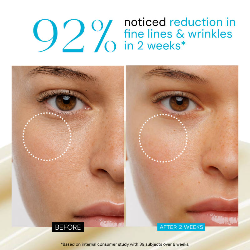 0.3% Retinol & Peptide Face Serum with Collagen For Anti-ageing, Fine lines & Wrinkles | Z8 - view 3