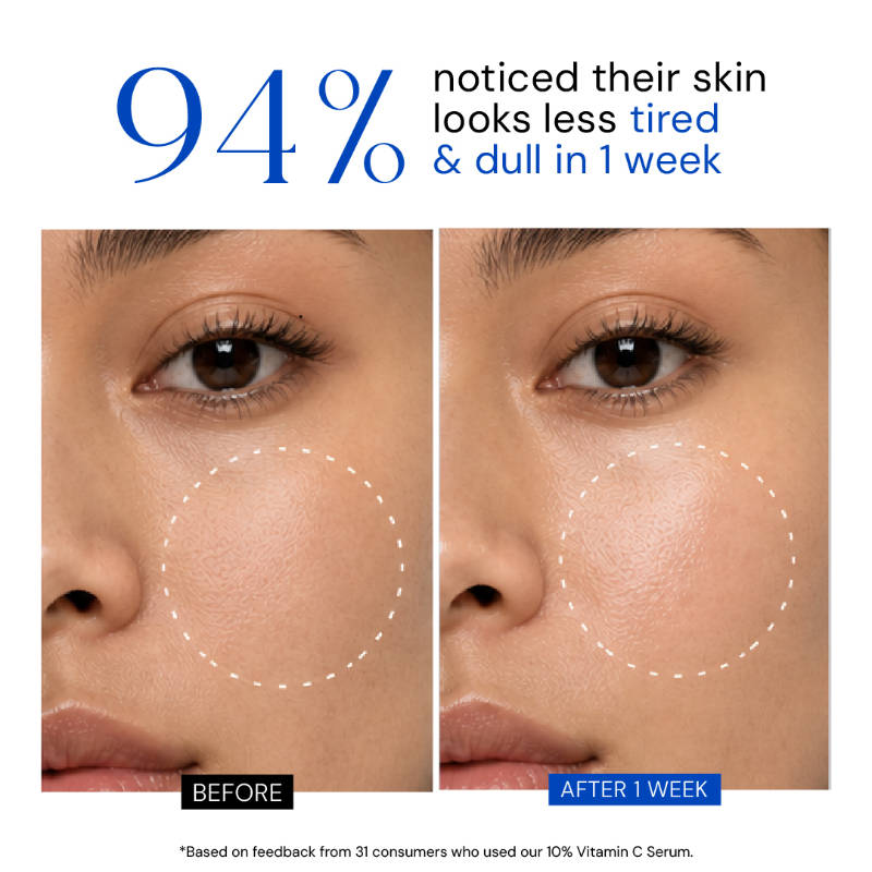 10% Vitamin C & Collagen Face Serum with Peptide+ Ferulic Acid, Pigmentation & Bright Skin | Z8 - view 3
