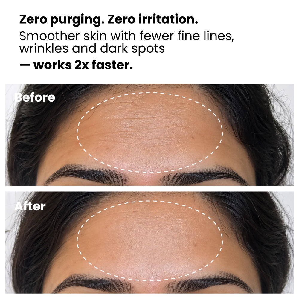 0.15% Encapsulated Retinol Night Serum | Z8 - view 5