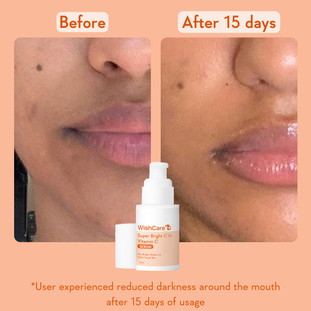 Super Bright C16 Vitamin C Face Serum for Glowing Skin- Reduces Pigmentation & Dark Spots | Z8 - view 2