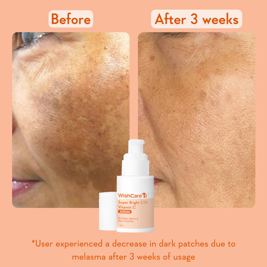 Super Bright C16 Vitamin C Face Serum for Glowing Skin- Reduces Pigmentation & Dark Spots | Z8 - view 3