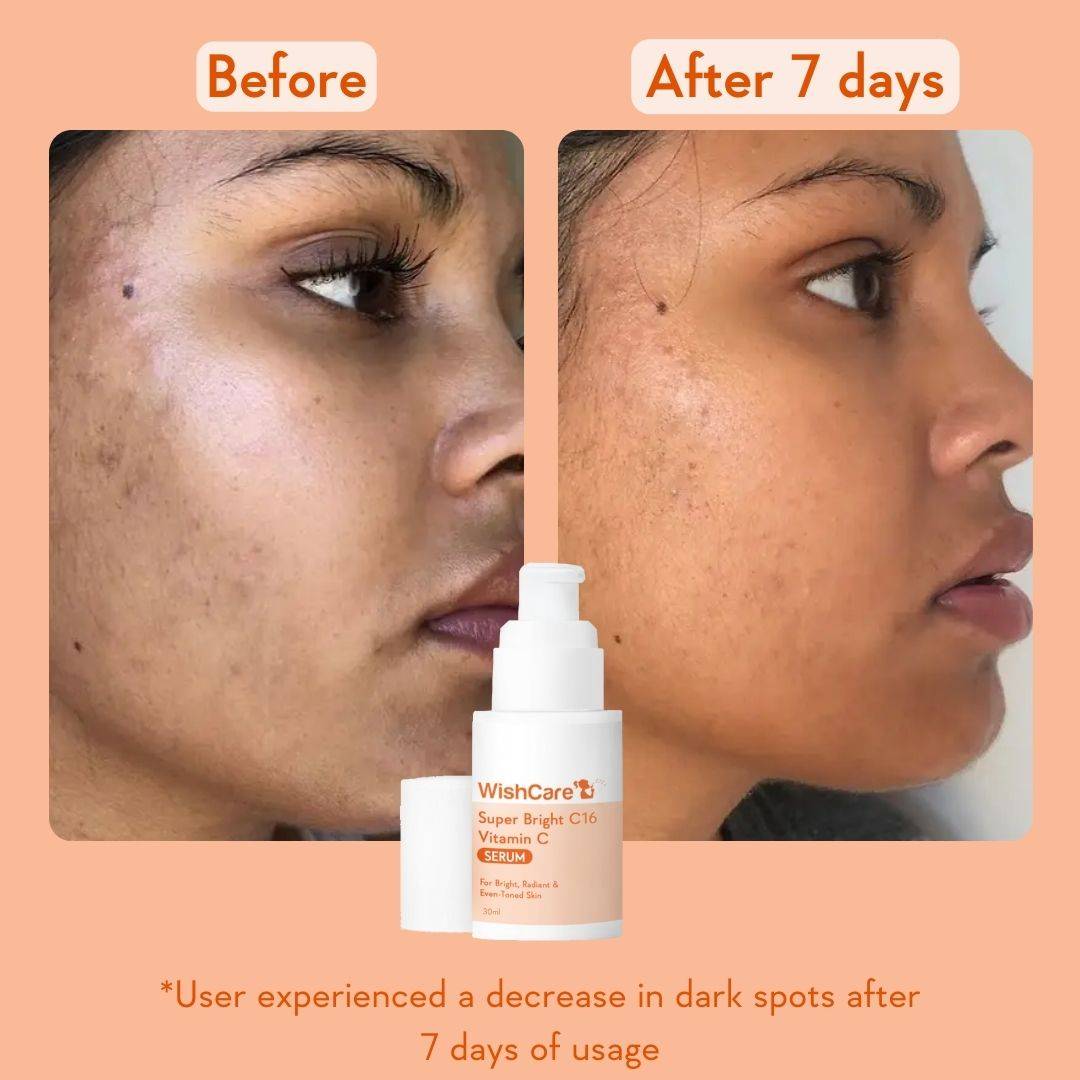 Super Bright C16 Vitamin C Face Serum for Glowing Skin- Reduces Pigmentation & Dark Spots | Z8 - view 4