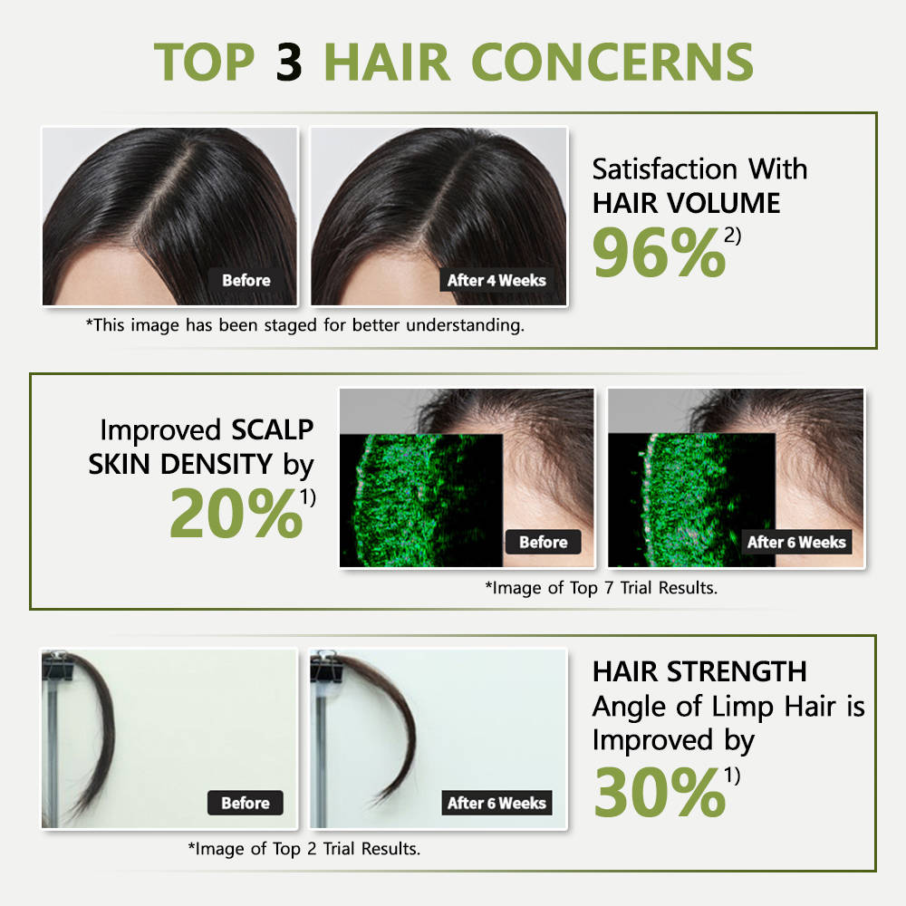 Root: Gen Hair Loss Care Shampoo For Women | H85 - view 2