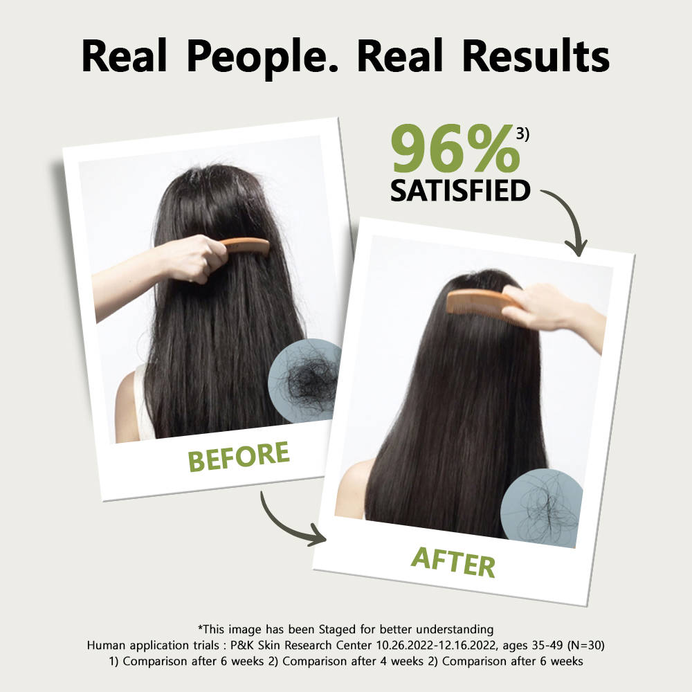 Root: Gen Hair Loss Care Shampoo For Women | H85 - view 4