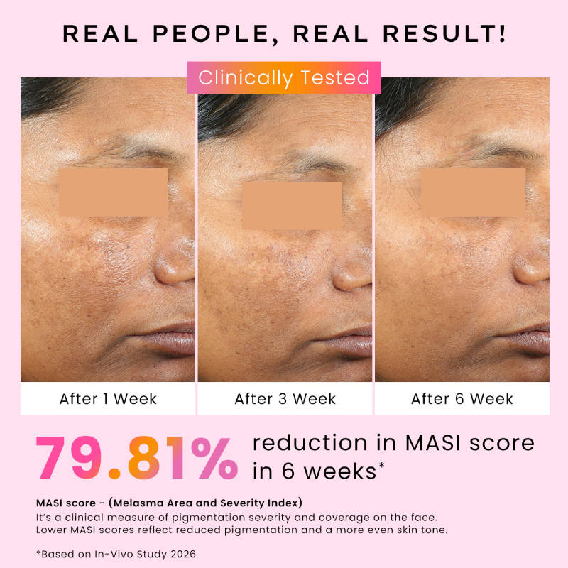 Biphasic Advanced De-Pigmentation Serum, Correct & Prevent Pigmentation In-Vivo Tested | FC3 - view 4