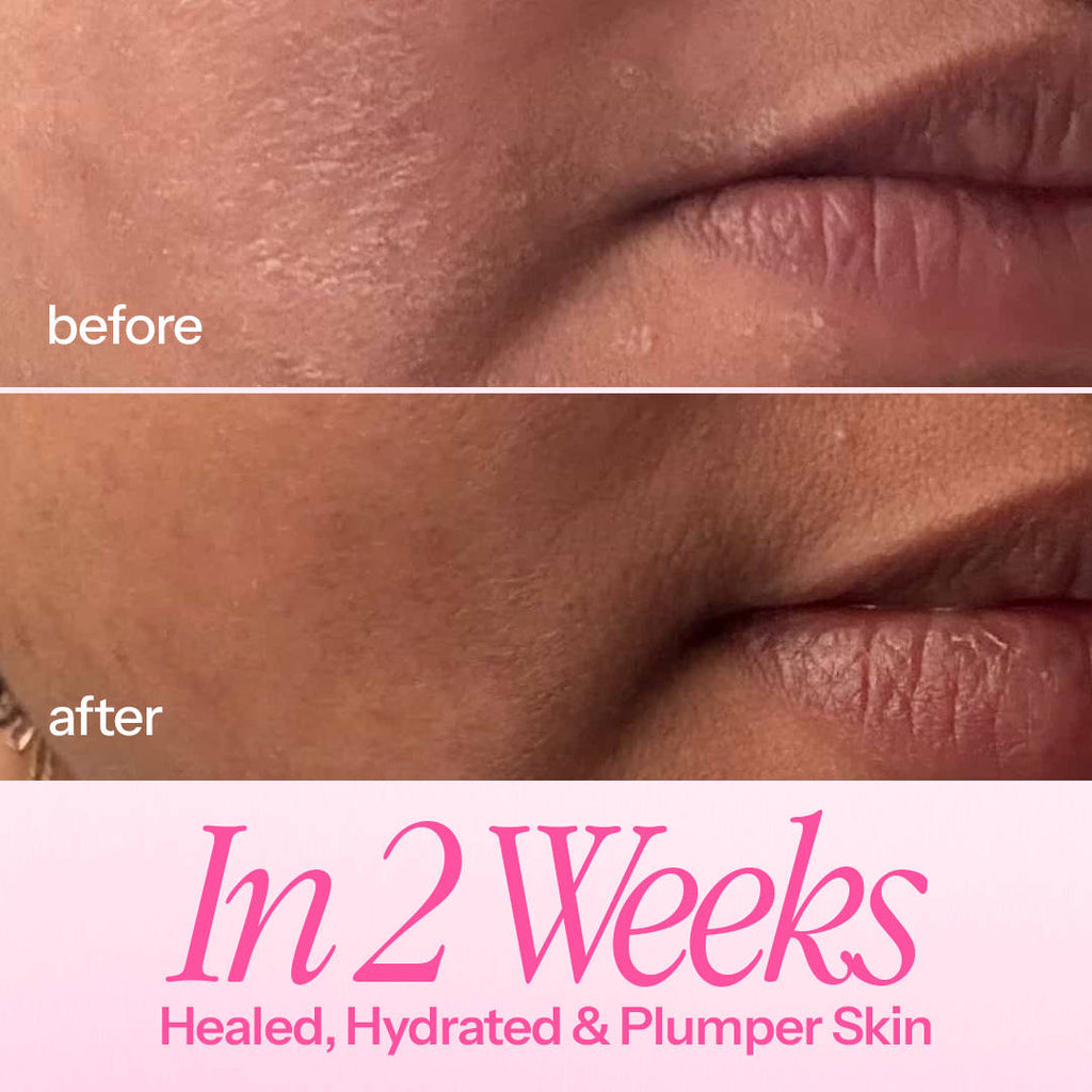 In My Defence Barrier-Building Moisturiser With 20x More Ceramides (Lightweight & Non-Greasy) | FC3 - view 4