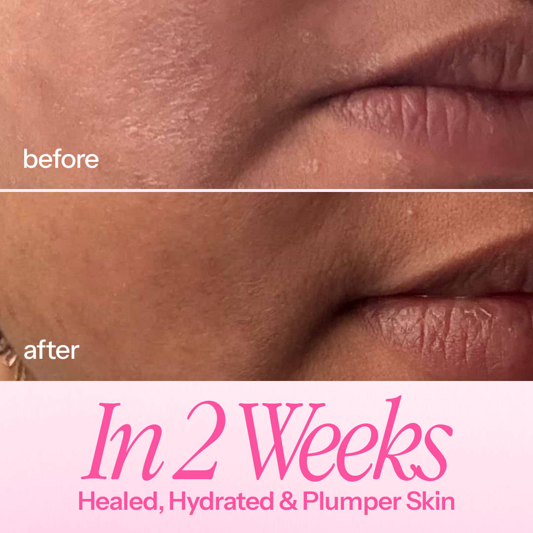 In My Defence Barrier-Building Moisturiser With 20x More Ceramides (Lightweight & Non-Greasy) | FC3 - view 4