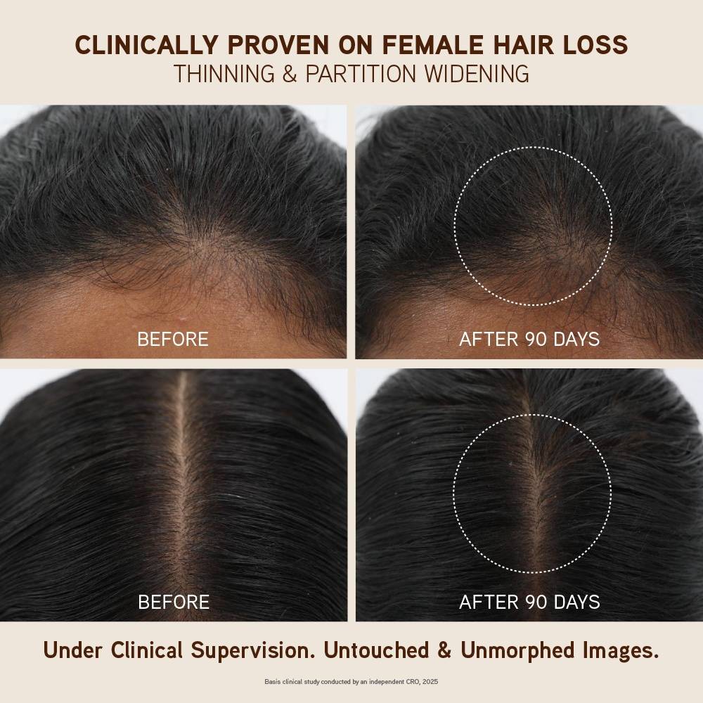 Bringha Hair Oil | H85 - view 2