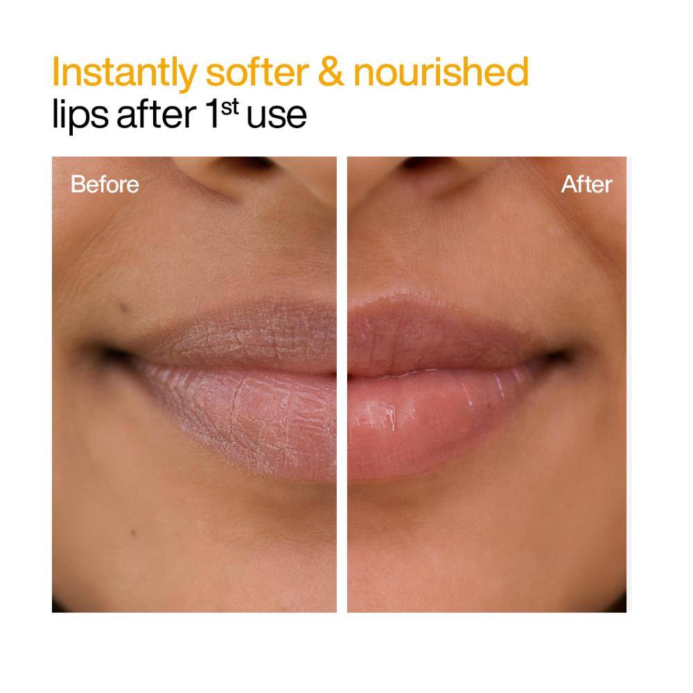 Natural Ceramide Lip Balm for Dark Pigmented Lips with SPF50 PA+++ Heals Dry & Chapped Lips | L12 - view 5