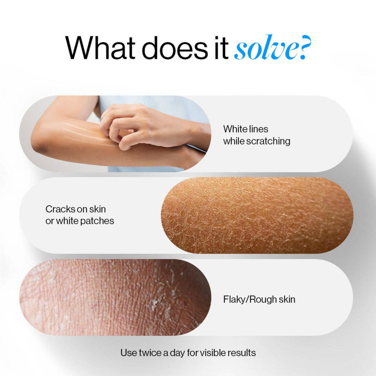 10% Urea Body Lotion With Ceramide For Very Dry & Flaky Skin | BWS9 - view 11