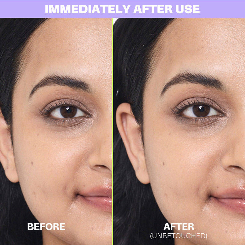 Peony BHA Serum with Peony Extract + Beta Hydroxy Acid | Z8 - view 6