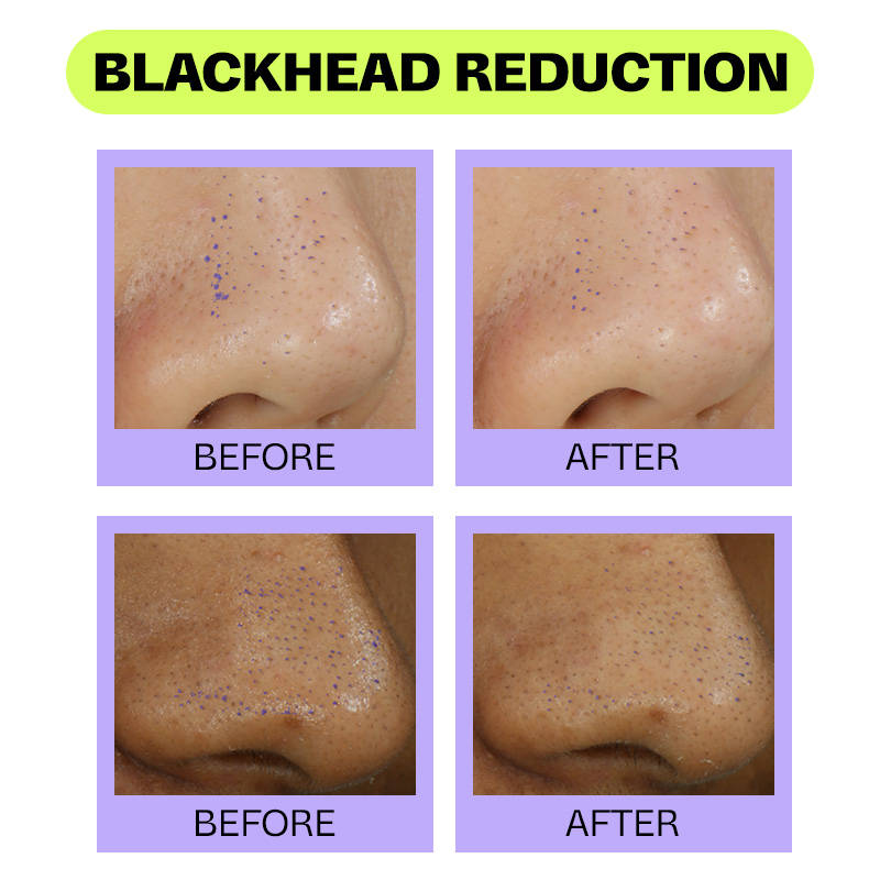Peony BHA Serum with Peony Extract + Beta Hydroxy Acid | Z8 - view 7
