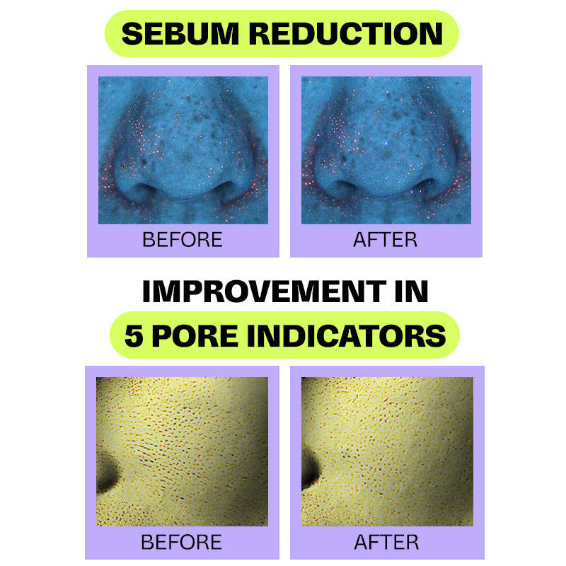 Peony BHA Serum with Peony Extract + Beta Hydroxy Acid | Z8 - view 8