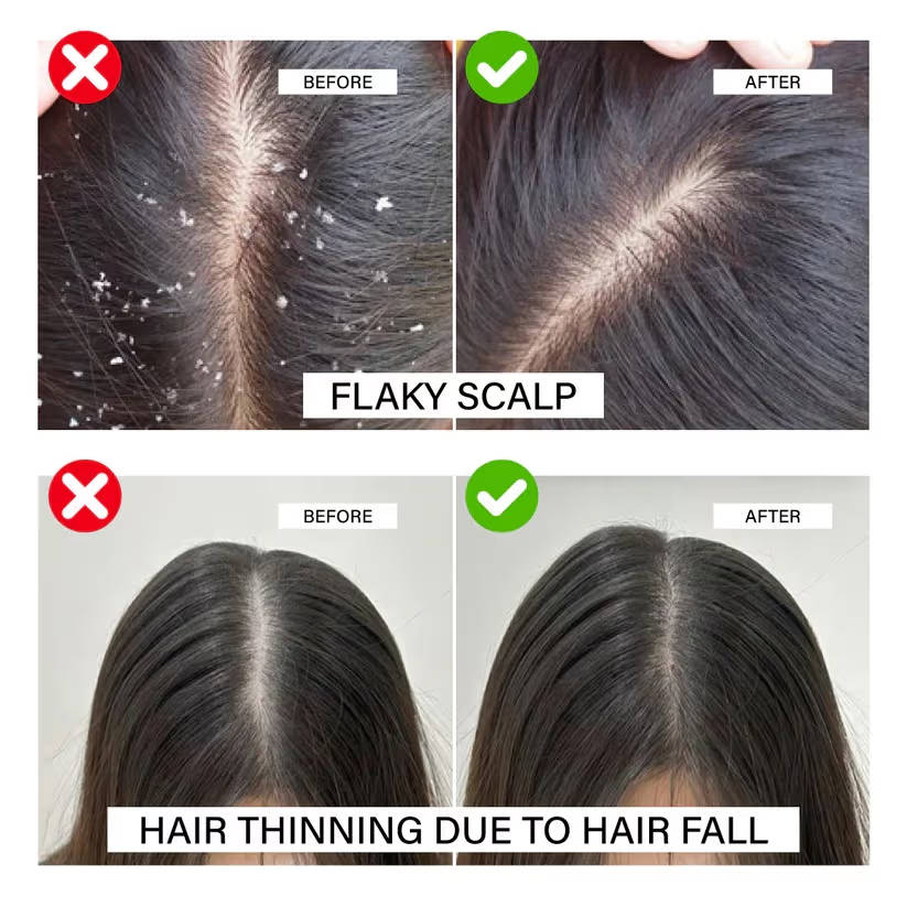 Herbal Hair Oil | H85 - view 5