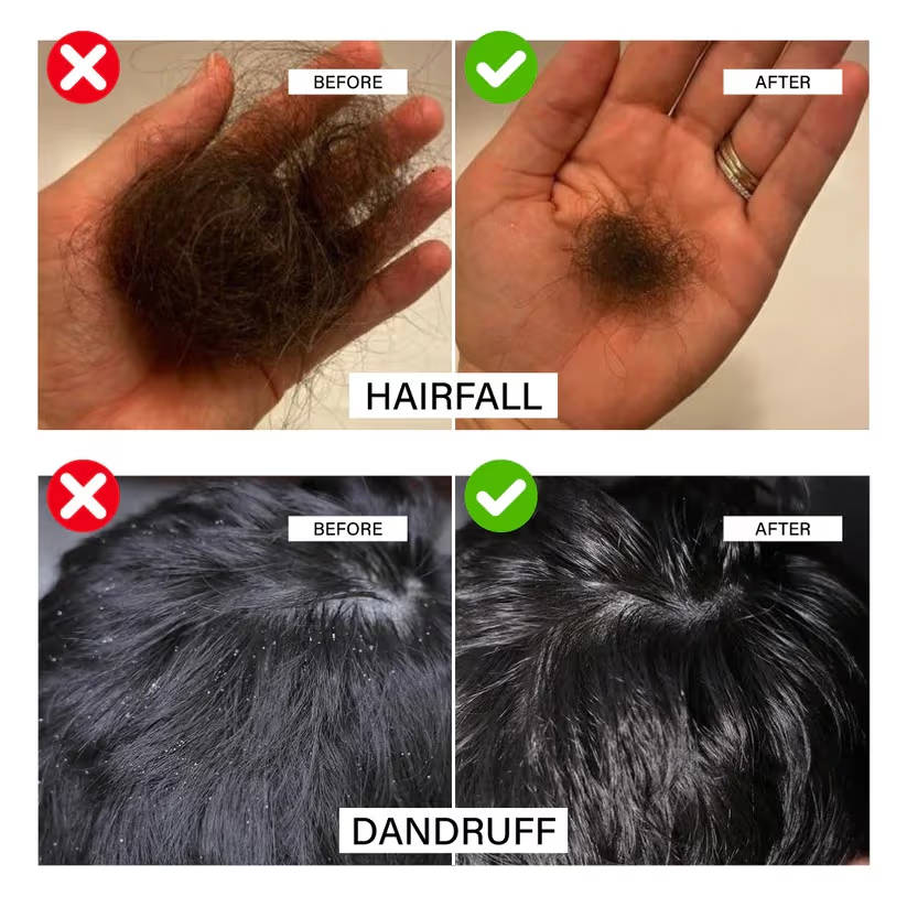 Herbal Hair Oil | H85 - view 6
