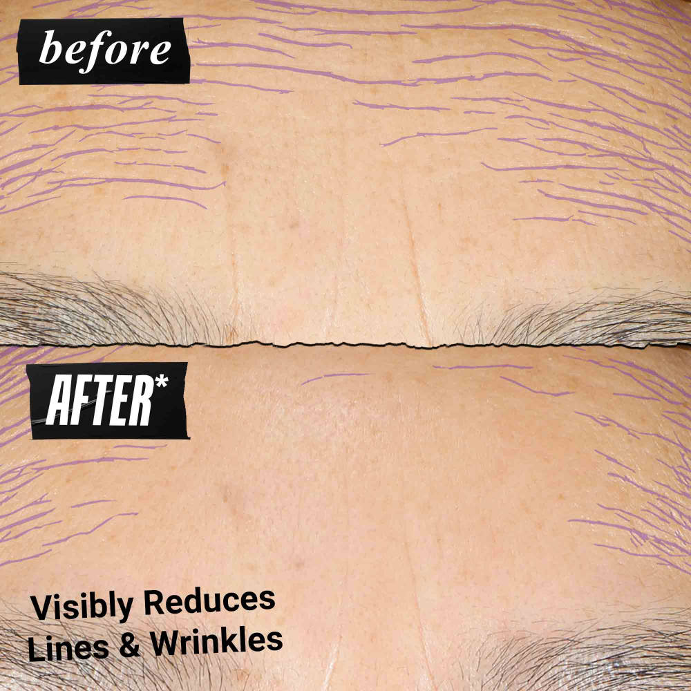 Micro-Dose Anti-Aging Retinol Serum - With Ceramides and Peptide | Z8 - view 3