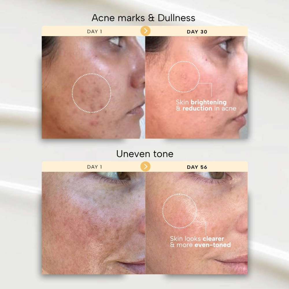 Radiance 24k Gold Hydrating & Brightening Face Gel Serum | Z8 - view 4