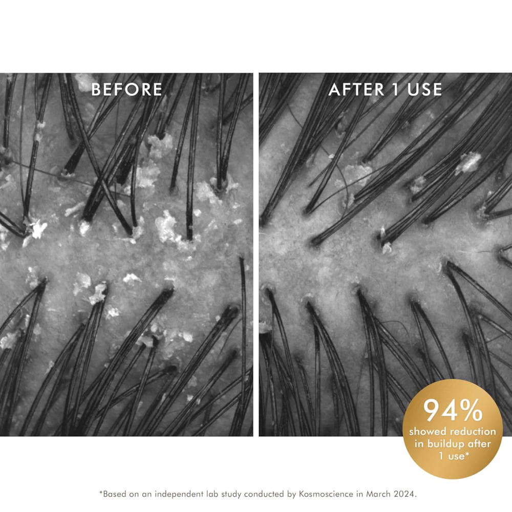 Purifying Pre-Wash Scalp Scrub Exfoliator for Flakes Oil & Buildup|Refreshes Hair &Scalp | H02 - view 5