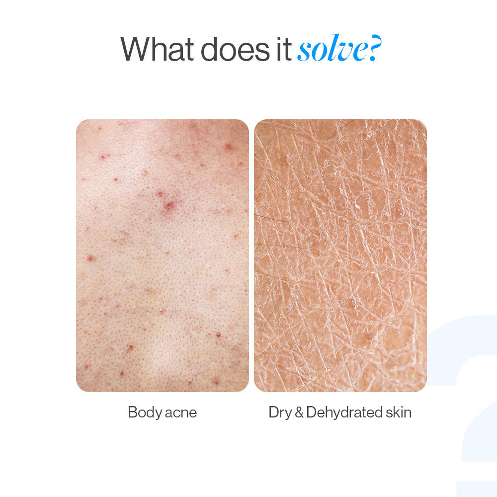 1% Salicylic Ceramide Body Wash - Dual Pump 2in1 Body Wash - For Body Acne and Dry Skin | BWS9 - view 4