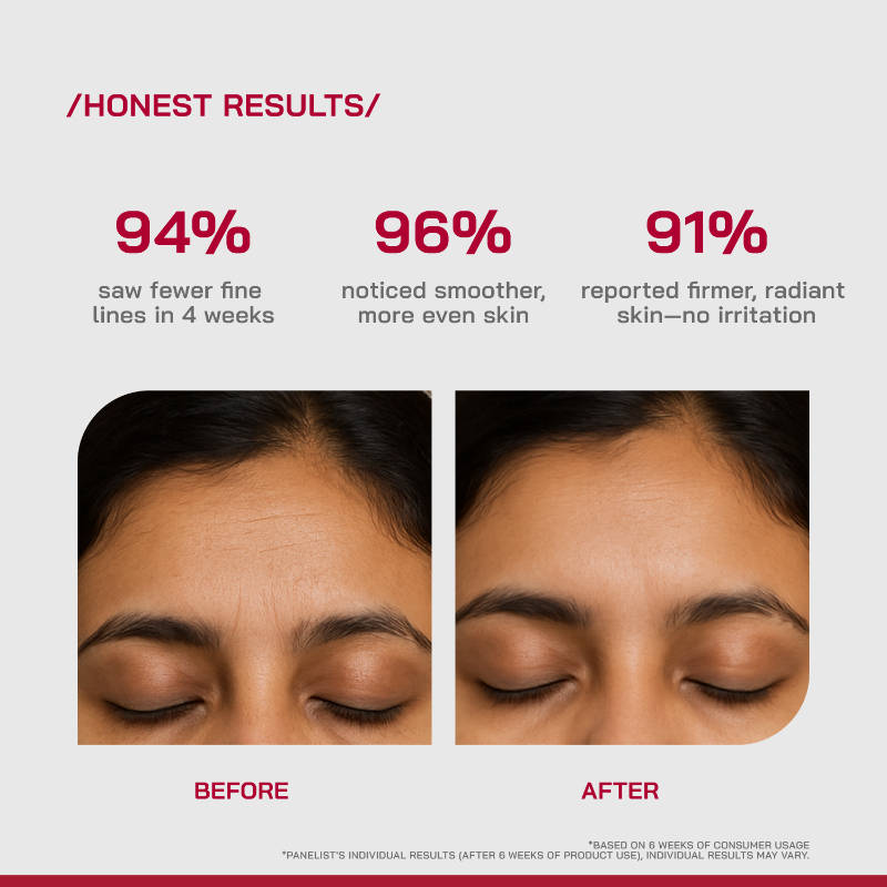 (PHD) 0.3% Retinol Serum With Bakuchiol & Peptides | Z8 - view 4