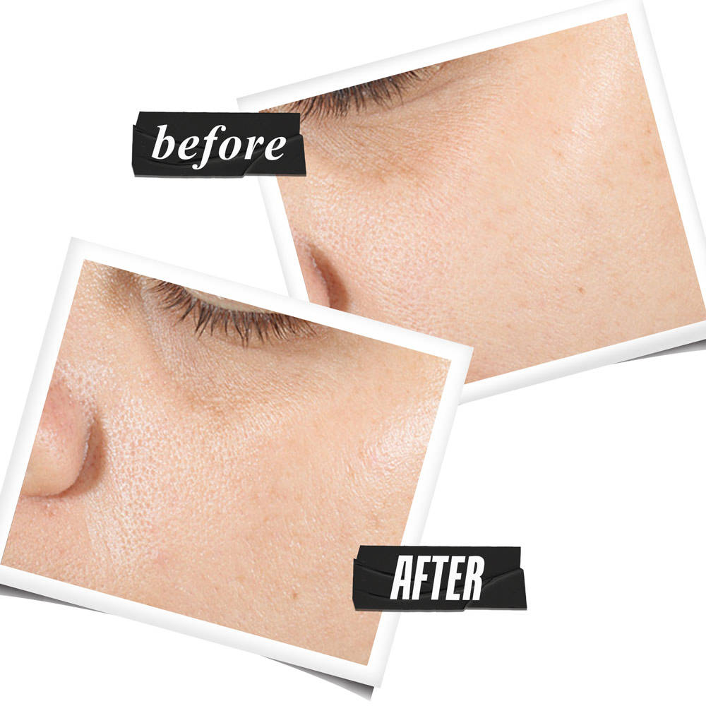 Ultra Pure High-Potency Serum - With 1.5 Hyaluronic Acid | Z8 - view 5