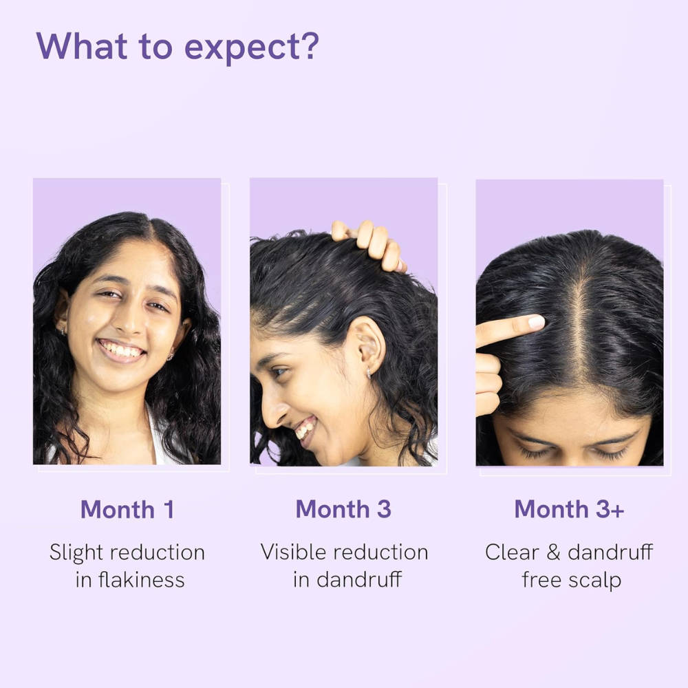 Anti Dandruff Hair Serum - Reduces Dandruff, Soothes Inflamed & Itchy Scalp | BWS9 - view 5