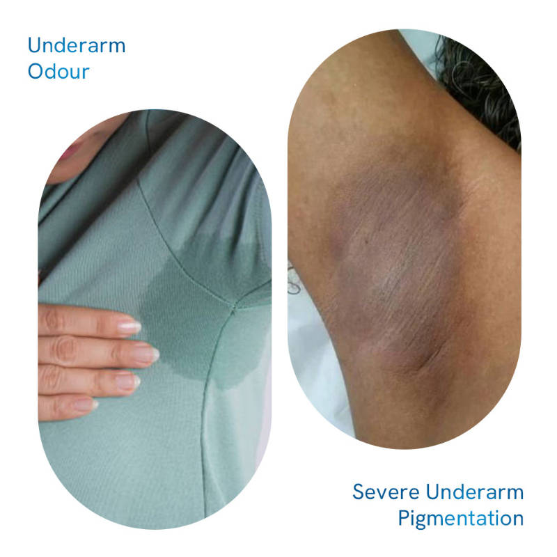 Pigmentation Repair Pack - 4% AHA BHA Underarm Roll On & Pigmentation Repair Cream | BWS9 - view 3