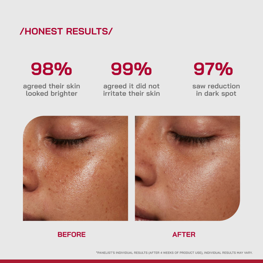 (PHD) 10% Vitamin C Brightening Serum | Z8 - view 4