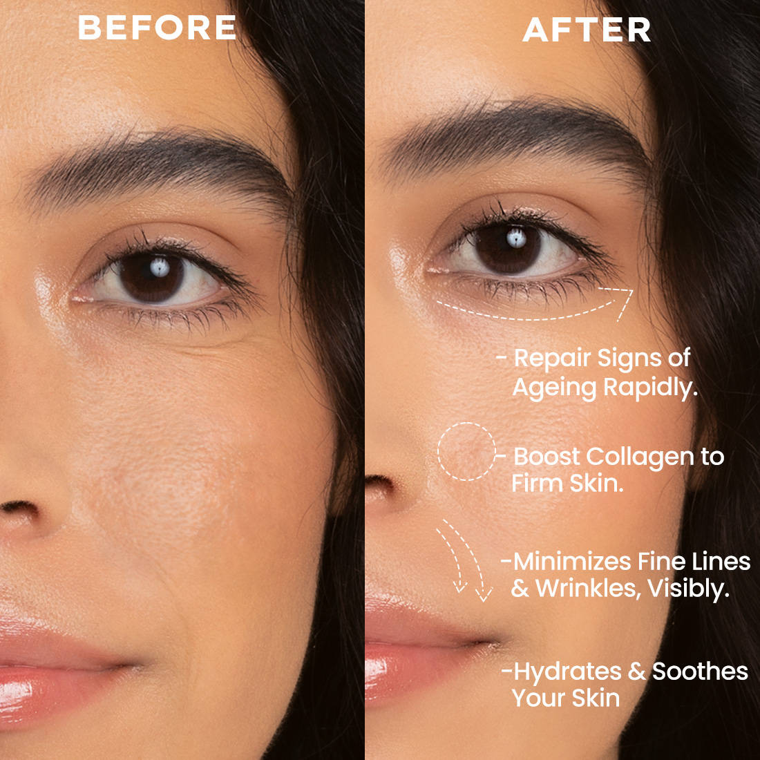 0.1% Retinal Reset, Retinol Derivative Serum Pro For Anti Aging, Reduce Fine Lines & Wrinkles | Z8 - view 4